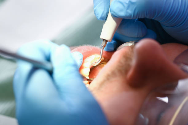 Trusted NC Emergency Dental Service Experts