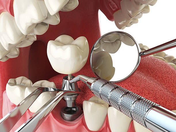  East Rockingham, NC Emergency Dentist Pros